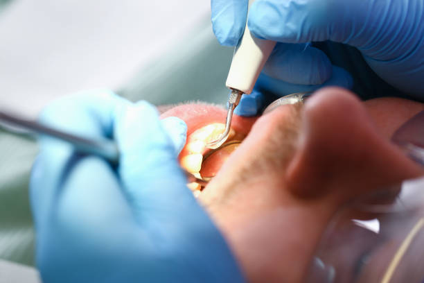 Best Emergency Dental Care for Sports Injuries in New Wilmington, PA